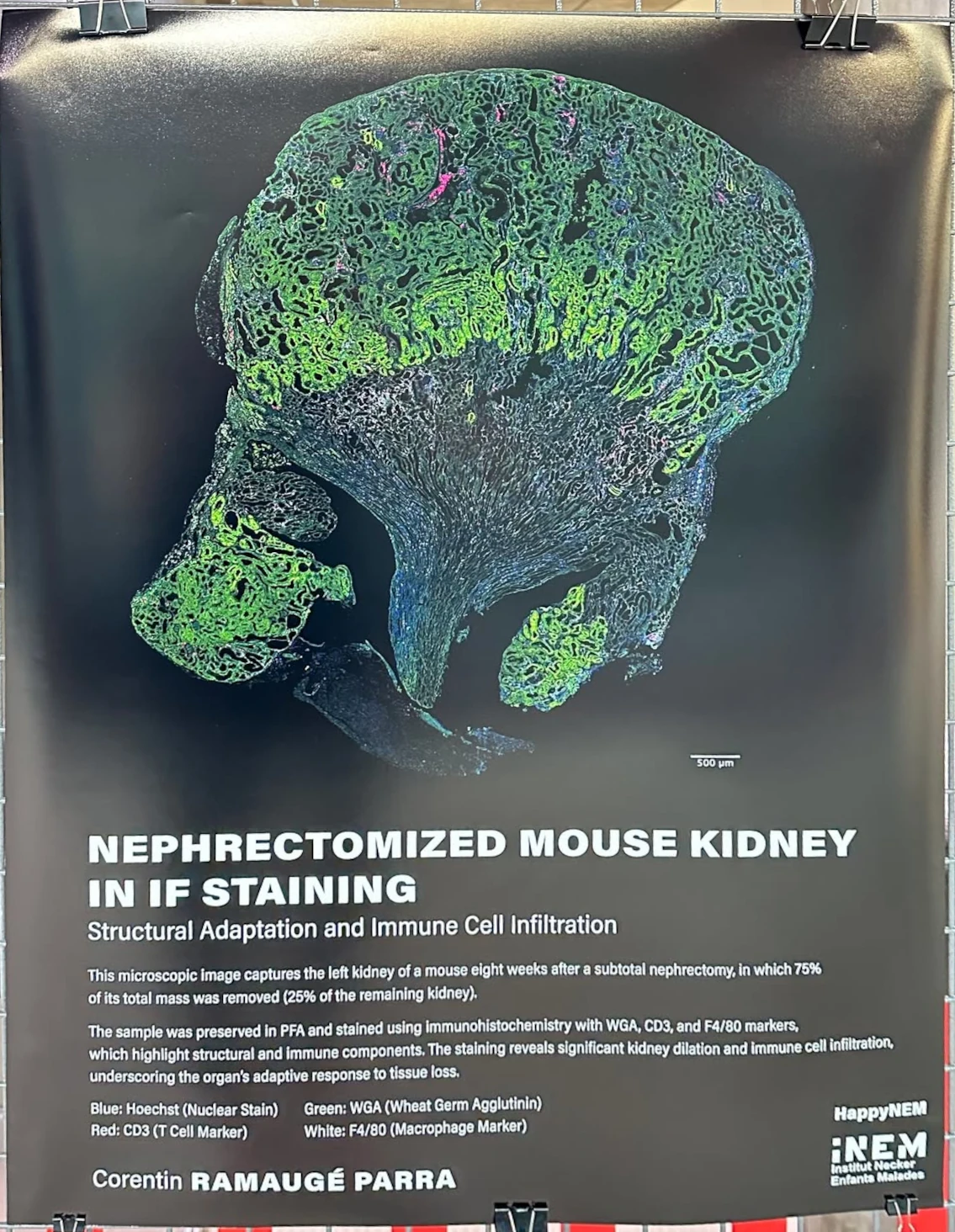 Nephrectomized Mouse Kidney in IF Staining